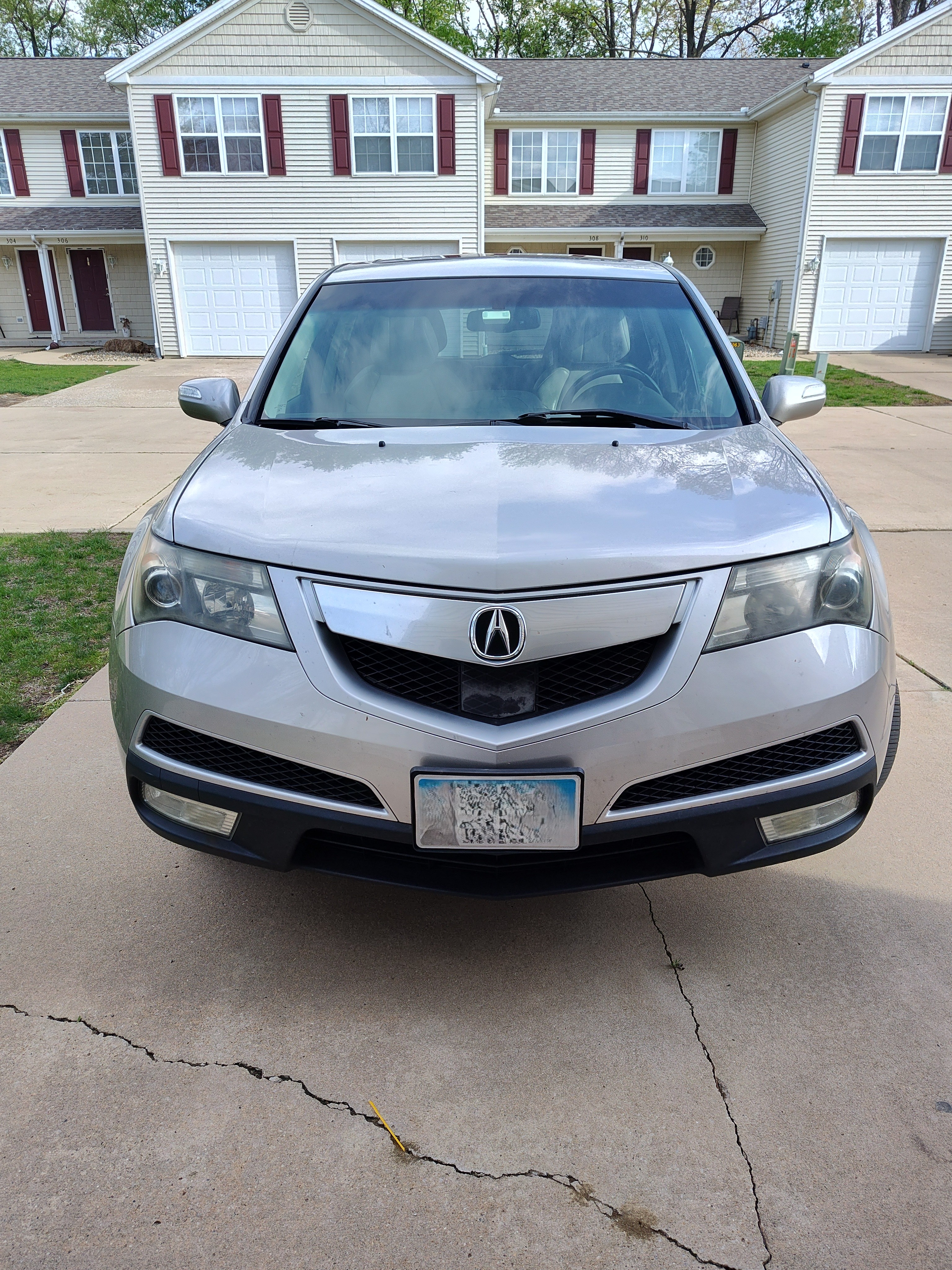 MDX frontal